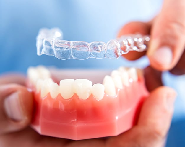 Invisalign Frisco